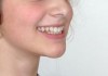 implanti-zubov